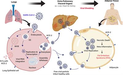 COVID-19 Severity in Obesity: Leptin and Inflammatory Cytokine Interplay in the Link Between High Morbidity and Mortality